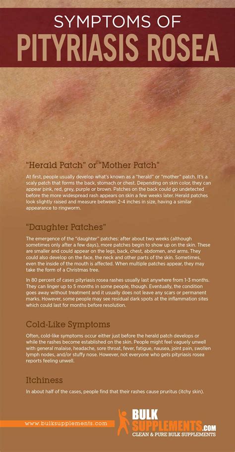 Pityriasis Rosea: Symptoms, Causes & Treatment by James Denlinger