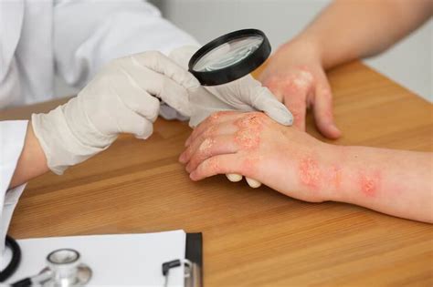 Skin Rashes Treatment Center in Plano, The Colony, Texas