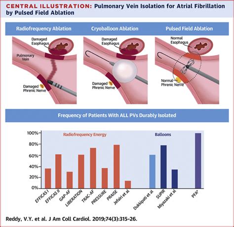 Pulsed Field Ablation for Pulmonary Vein Isolation in Atrial ...