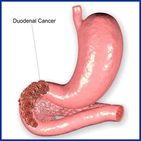 Duodenum