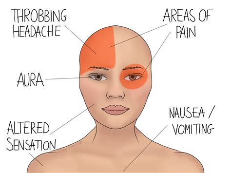 Migraine Prevention and Management