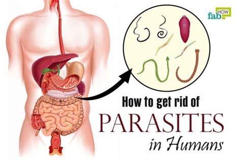 Pin on Parasite cleanses