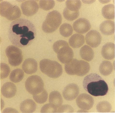 Wright's stain of a blood smear, using the GSA. | Download Scientific ...