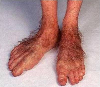 Foot Pictures, Funny Pictures, Random Pictures, Funny Pics, Toe Pics ...