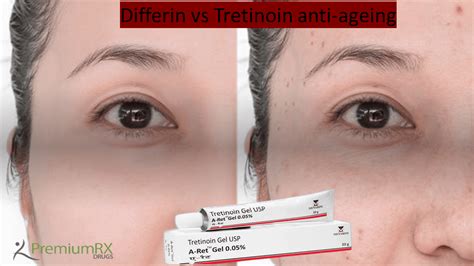 Differin vs Tretinoin anti-ageing | PremiumRx- Online Pharmacy