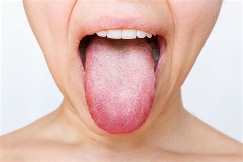 “Een paarse tong kan erop wijzen dat je kanker hebt”: wat vertelt je tong over je gezondheid ...