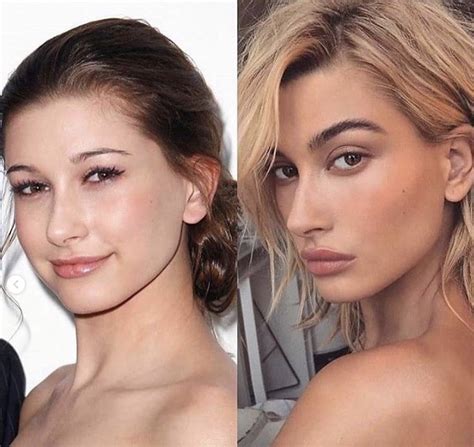 Hailey Bieber slams accusations that she underwent plastic surgery | Celebrity surgery ...