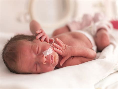 Premature Babies | BabyCenter