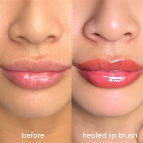 Is Lip Blushing Worth It? What You Can Expect