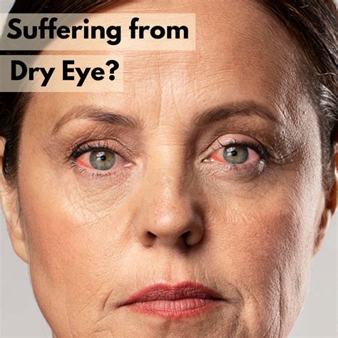 Dry Eye: Cause, Symptoms & Supplements | Basic Brands Inc.