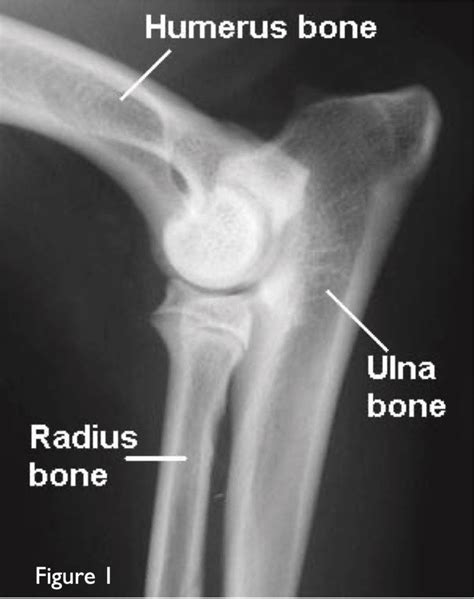 ELBOW DYSPLASIA IN DOGS - Veterinary Specialists Aotearoa | Veterinary Specialist and Animal ...