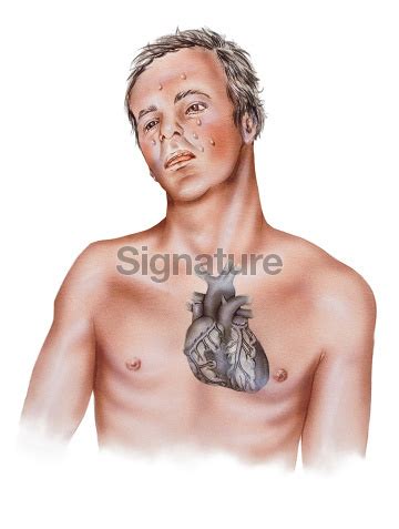 Heart - Attack Symptoms in a Male Patient 이미지 (133283841) - 게티이미지뱅크
