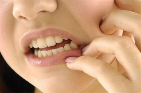 Why Do You Have Itchy Gums? - Brookhaven Dental Group
