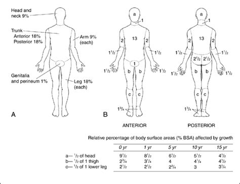 Burn Notice Blog Edition: Diagnosis/Classification of Burns