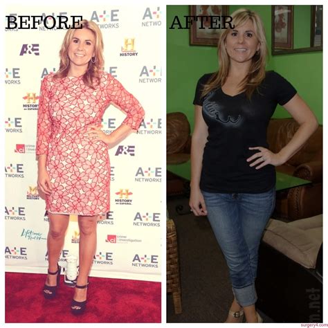 Brandi Passante Plastic Surgery Photos [Before & After] ⋆ Surgery4