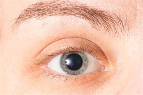 Mydriasis (Pupil Dilation): Causes, Treatment and More | MyVision.org