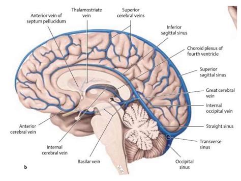 Tentorial meningiomas