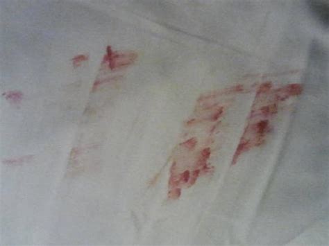 Disgusting - Picture of Chelsea Hotel, Toronto, Toronto - TripAdvisor