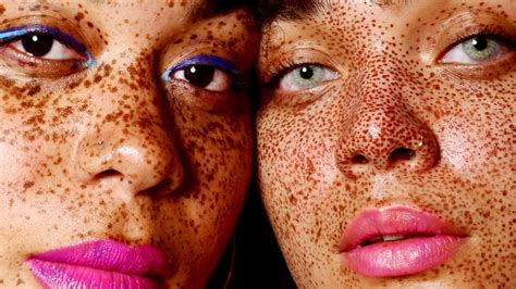 What Causes Freckles? Here's How They Form