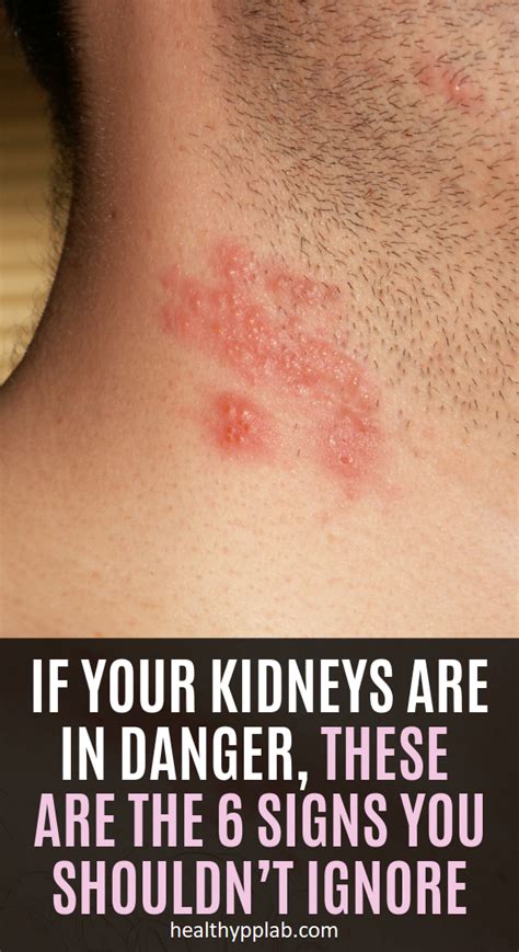 If Your Kidneys Are In Danger, These Are The 6 Signs You Shouldn’t Ignore – Healthy PP Lab in ...