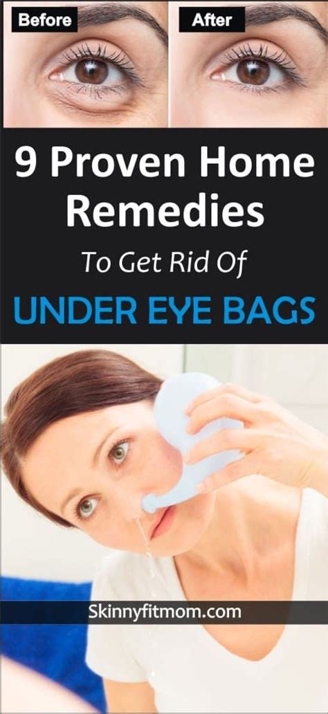 Learn how to get rid of under eye bag. These 9 home remedies are tested ...