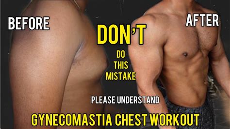 HOW TO LOSE CHEST FAT FOR MEN with 3 EFFECTIVE WORKOUTS | GYNECOMASTIA ...