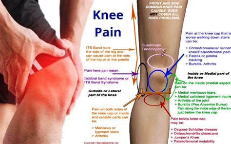 Knee pain homeopathic treatment right knee left knee by dr makkar – Artofit