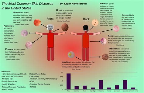 Infographic: The Most Common Skin Diseases in the U.S. – SLI