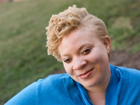 People Of Color With Albinism Ask: Where Do I Belong? | NCPR News