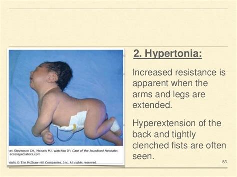 Neonatal examination