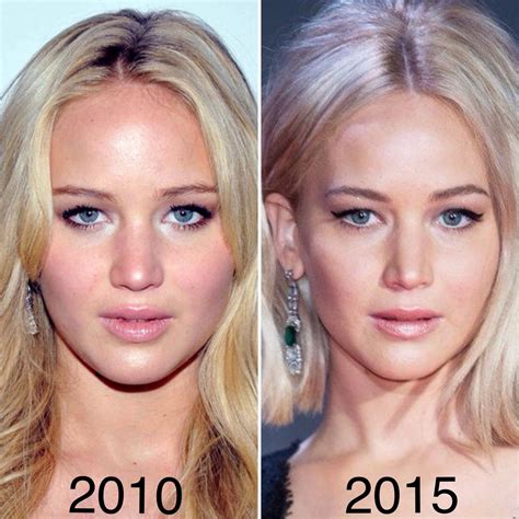 Jennifer Lawrence Nose Job Before And After