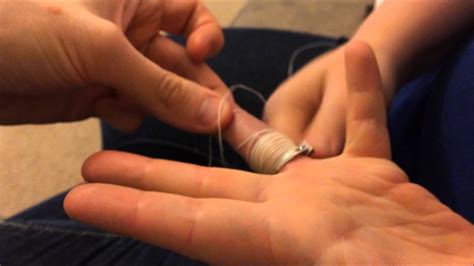 How to remove a ring from a swollen finger - YouTube