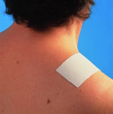 Pain-relief Patch On A Patient's Shoulder Photograph by Sheila Terry/science Photo Library