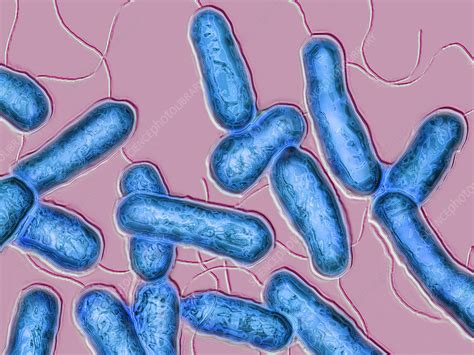 Legionella Pneumophila, LM - Stock Image - C028/3458 - Science Photo Library