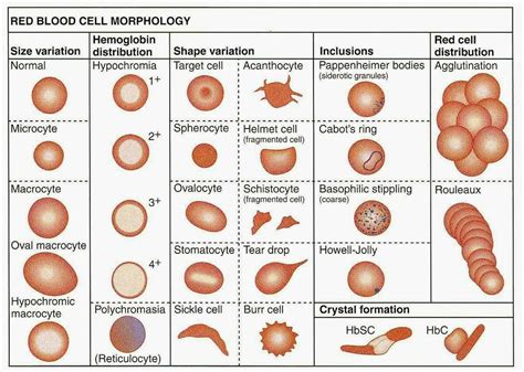 Morphology of RBC | Medical laboratory, Medical laboratory scientist ...