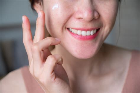 Oral Acne Medication: What You Should Know