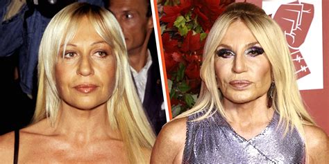 Before and After Donatella Versace Plastic Surgery - The Hub