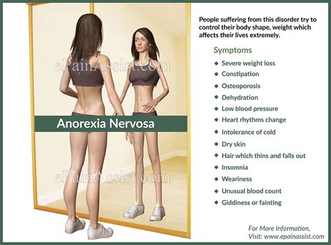 Anorexia Nervosa|Causes|Signs|Symptoms|Treatment|Types