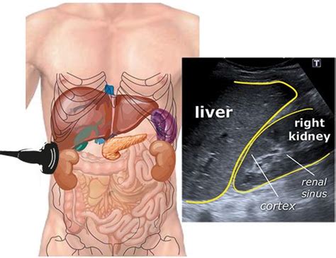 Whole Abdomen Scan W/ Directions & Pictures! 👍🏻 | Ultrasound sonography, Ultrasound technician ...