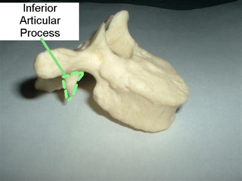 Articular processes - Wikiwand