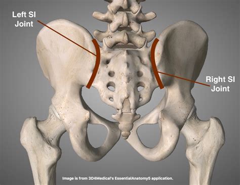 The SI Joint....from A PT Perspective | CHARM