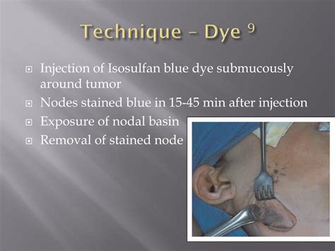 PPT - Role of Sentinel Lymph Node biopsy in head and neck cancer ...