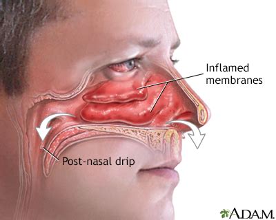 Runny Nose Anatomy