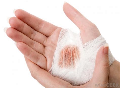 types of wound dressings - pictures, photos