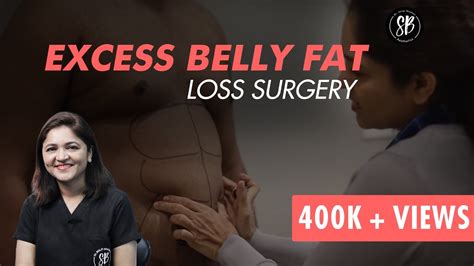 Liposuction Procedure: Abdominal Surgery | Excess Belly Fat Removal Surgery | Dr. Shilpi Bhadani ...