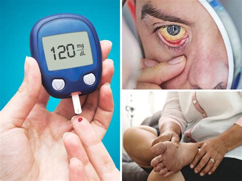 10 Warning Symptoms of Diabetes That May Appear On Your Skin