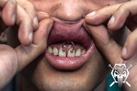 Labial Frenulum Piercing