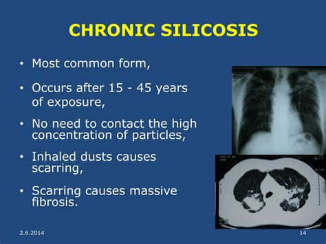 PPT - SILICA EXPOSURE PowerPoint Presentation, free download - ID:633529