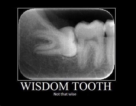 Funny Wisdom Teeth Photos To Share With Someone After Surgery | Wisdom teeth, Dental humor ...