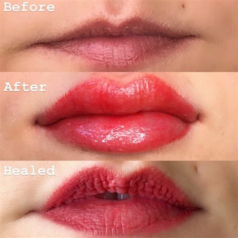 Permanent Lip Color Healing Process